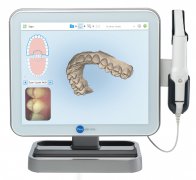 iTero口腔扫描仪入驻光大，3分钟舒适取模