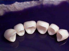 紫金县你对于美容冠牙齿治疗了解吗 